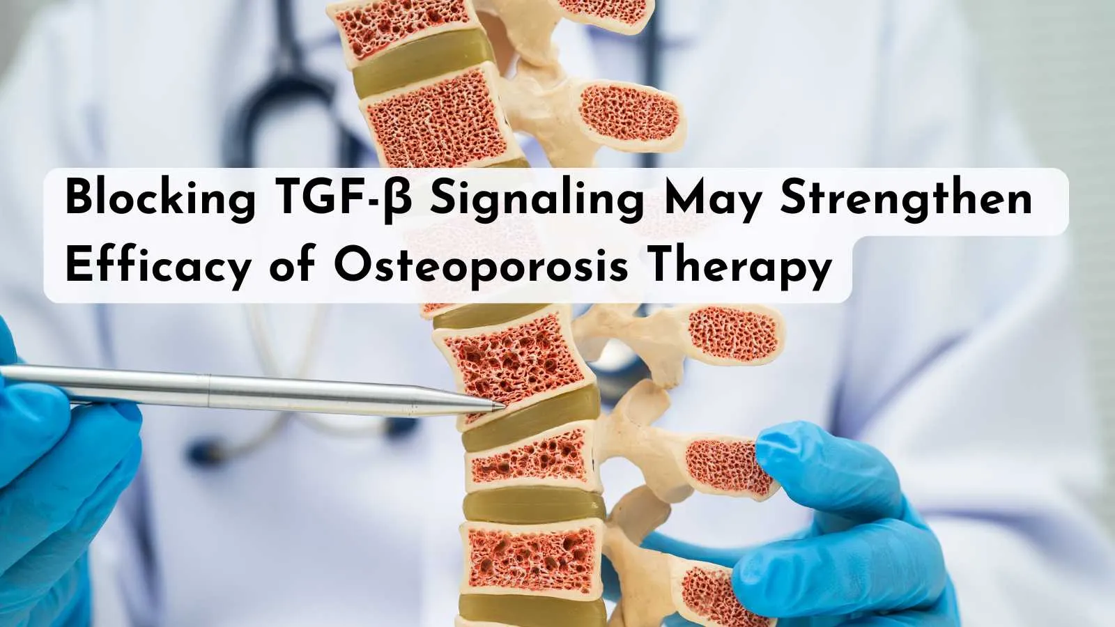 Blocking TGF-β Signaling May Strengthen Efficacy of Osteoporosis Therapy