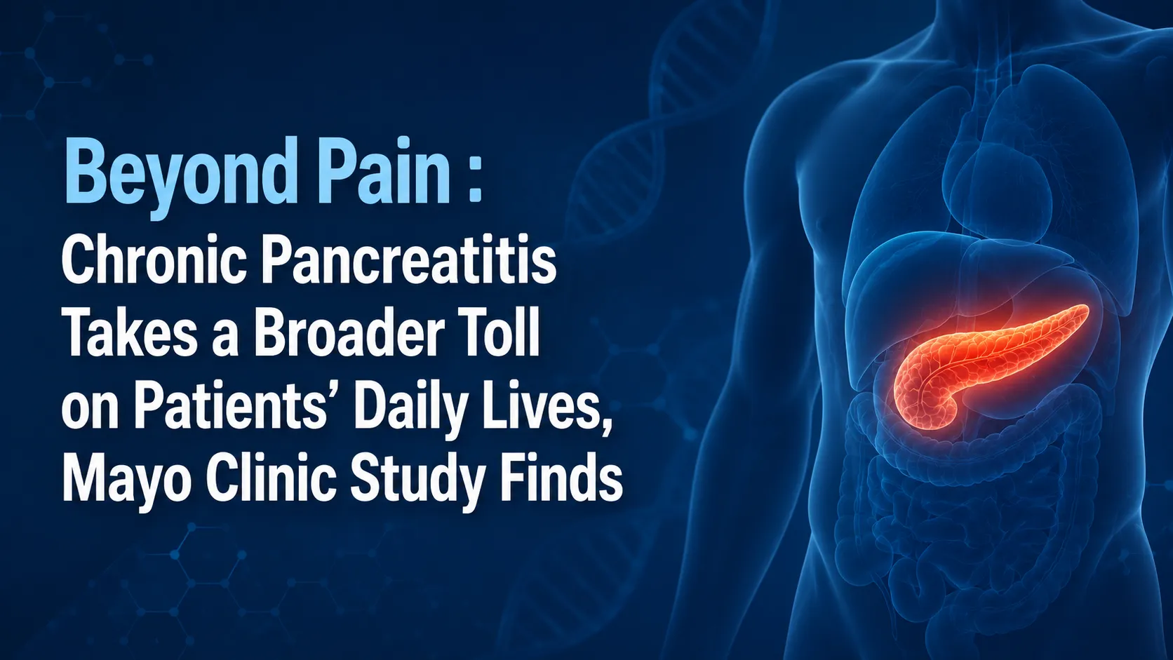 Beyond Pain : Chronic Pancreatitis Takes a Broader Toll on Patients’ Daily Lives, Mayo Clinic Study Finds