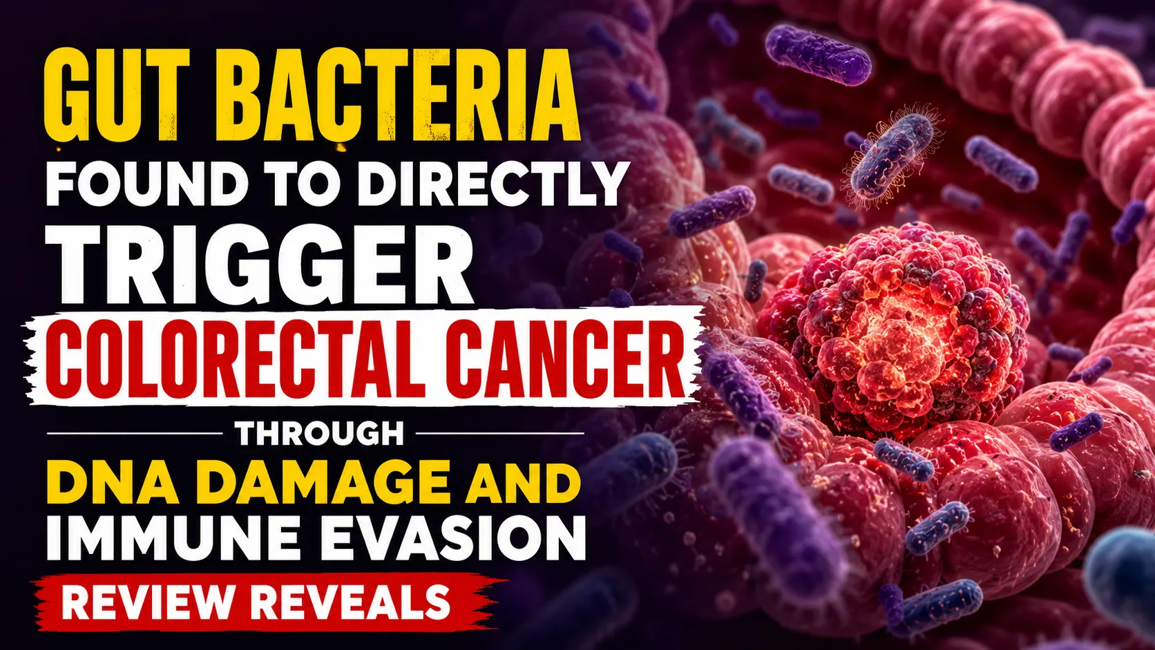 Gut Bacteria Found to Directly Trigger Colorectal Cancer Through DNA Damage and Immune Evasion, Review Reveals