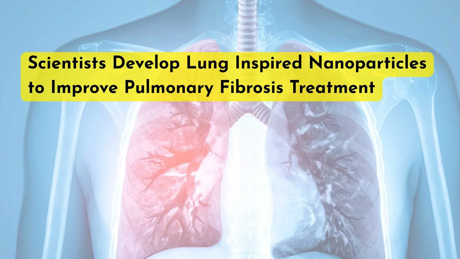 Scientists Develop Lung Inspired Nanoparticles to Improve Pulmonary Fibrosis Treatment