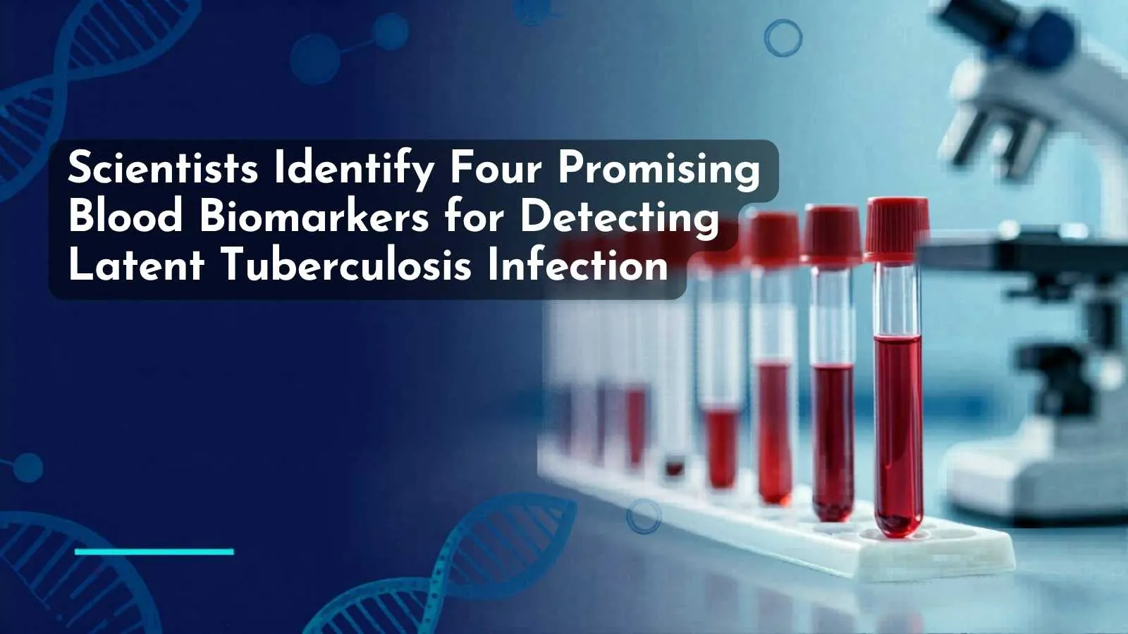Scientists Identify Four Promising Blood Biomarkers for Detecting Latent Tuberculosis Infection