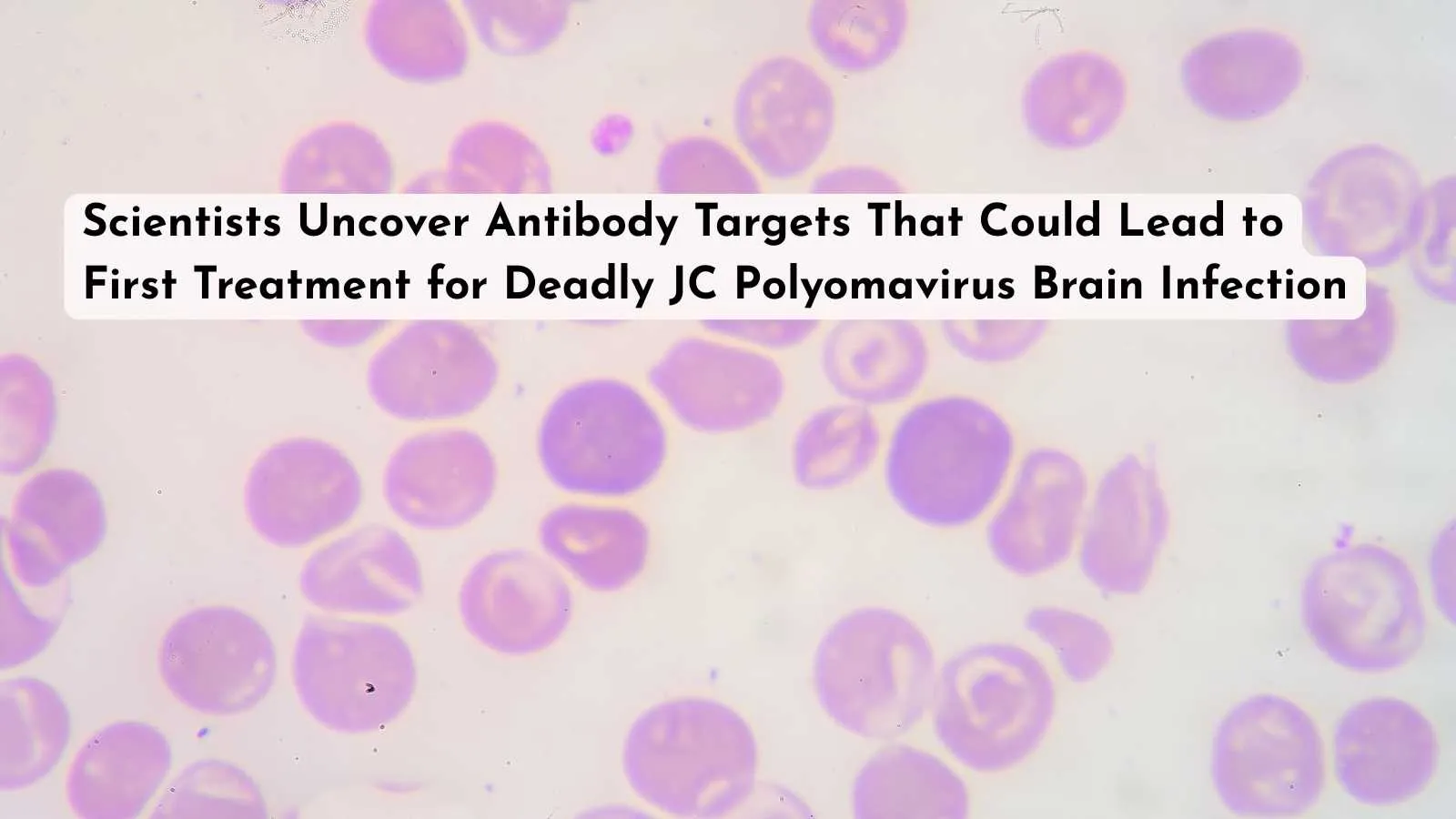Scientists Uncover Antibody Targets That Could Lead to First Treatment for Deadly JC Polyomavirus Brain Infection