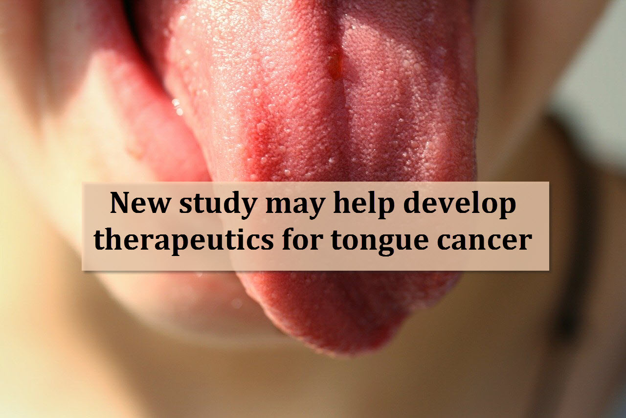 New study may help develop therapeutics for tongue cancer | PharmaTutor